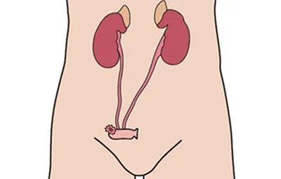 Urostoma
